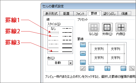 ヘアラインの修正-2