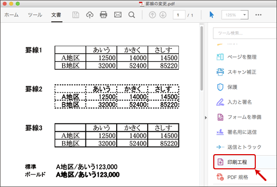 ヘアラインの修正-3