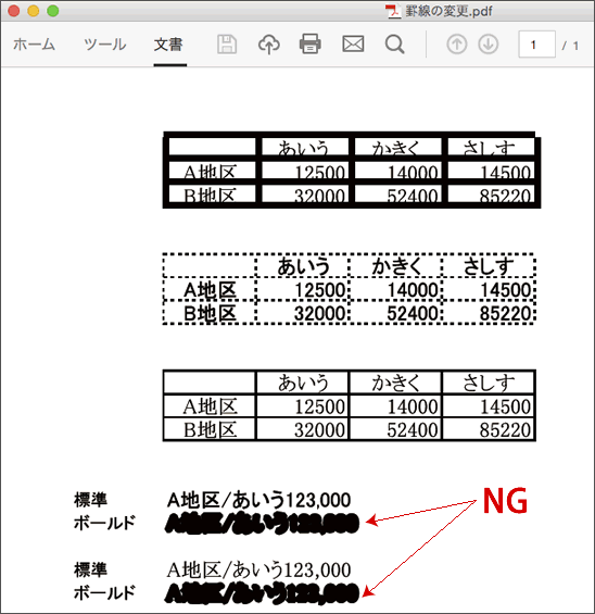 ヘアラインの修正-5